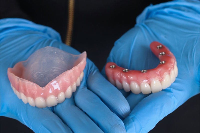 Removable Prosthetics - Detec Dental