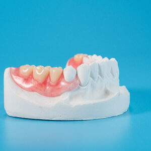 Detec Flexible Resin Partial Denture Base