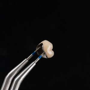 Detec Titanium PFM Implant Crown