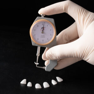 Emax Press Crowns and Veneers