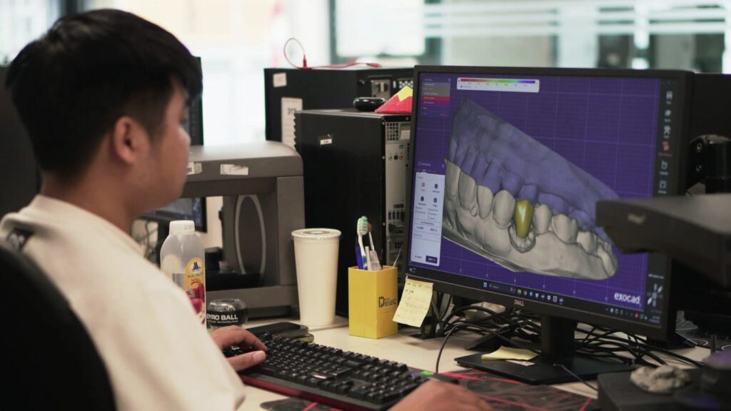 Person working on computer with 3D dental scan on screen.