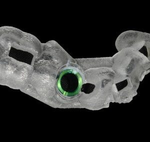 Implant Surgical Guide