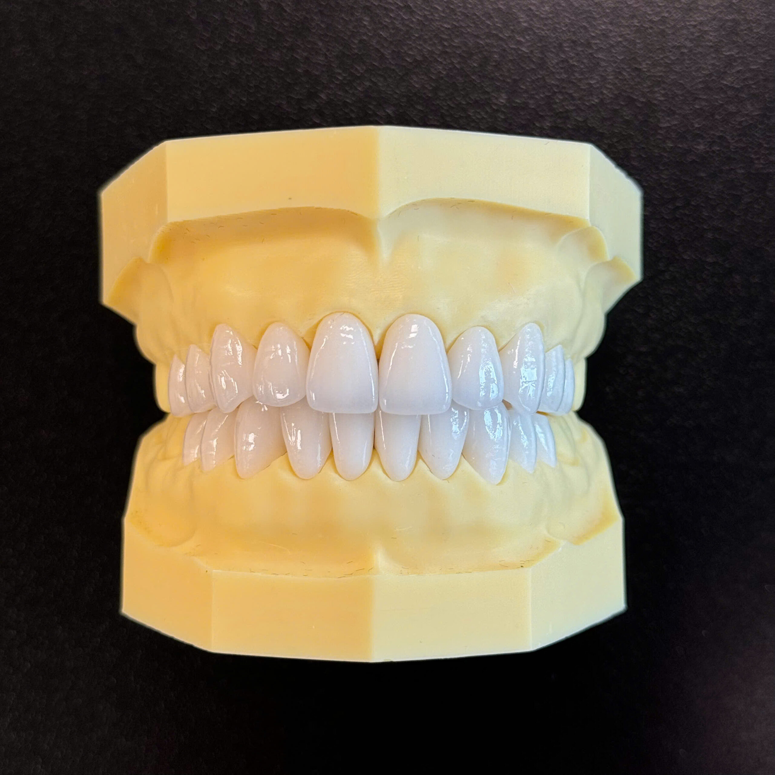 Detec Zirconia ST Crown