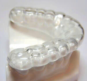 Detec Rigid Acrylic Nightguard