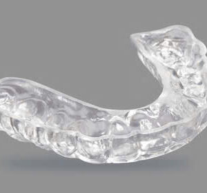 3D Resin Model Printing (Dual Arches)