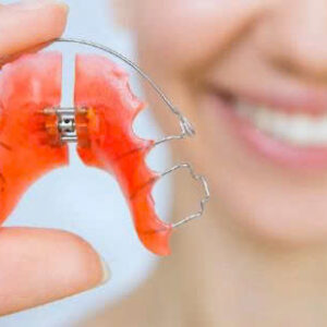 DetecAlign Hawley Appliance - First Delivery/Phase 1