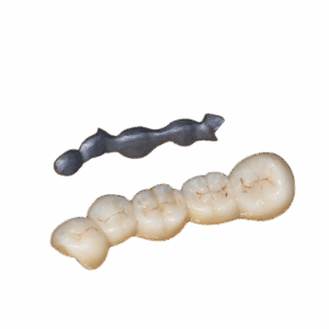 Detec E-Bar for Dental Bridges